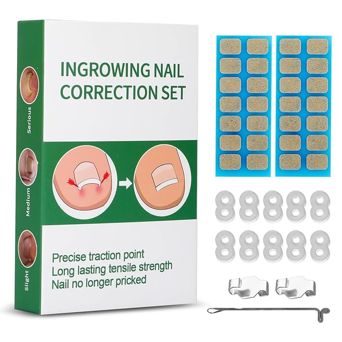 Ingrown Toenail Treatment, 10 packs Ingrown Toenail Corrector, Ingrown Toenail Removal Kit for Curved Nail Repair, Corrector for Man and Women All Size Toenail