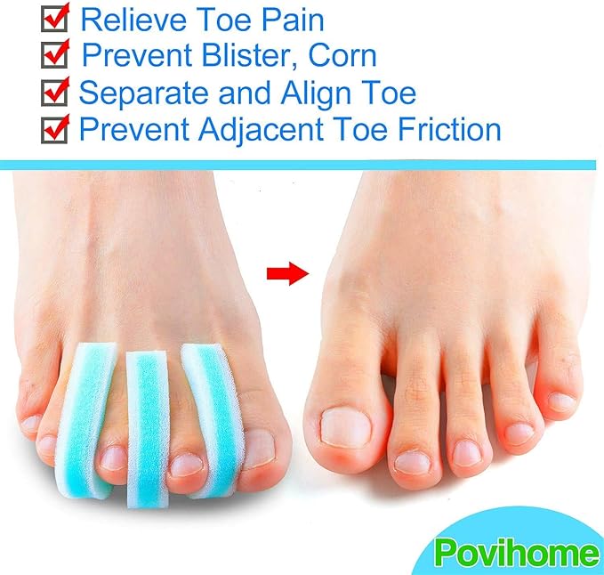 Povihome 10 Pack Foam Toe Spacers(2/5" Thick), 3-Layer Toe Separators - Large Size - to Align Crooked, Overlapping Toe, Relieve Corn, Blister and Reduce Irritation