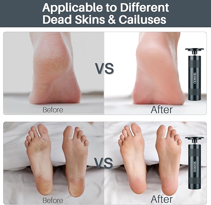 Callus Remover for feet,Nail Filer,Electric Foot Filer with 60Pcs+12Pcs Sandpaper Discs，Gifts for Woman/Men Birthday Christmas Stocking Stuffers Foot Repair Tool-Grey