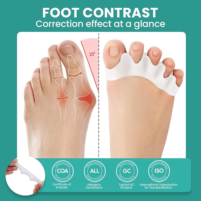 Welnove Toe Separators Spacers for Women - 8 Pack Gel Toe Straightener to Correct Bunions and Relieve Foot Pain - Silicone Toe Spacers for Hammertoe Yoga Practice - White