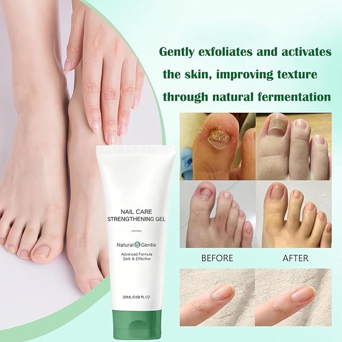 Natural Nail Care Gel, Nutraboost Strengthening Cuticle Serum for Damaged & Brittle Nails, 20ml (1 pcs) (1pcs)