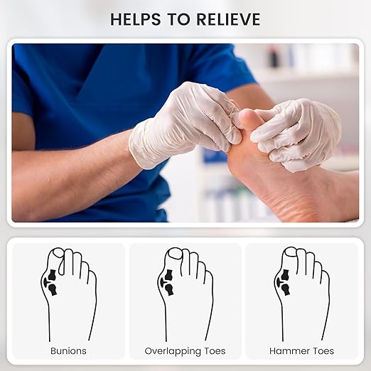Toe Separators for Women, Yoga Toes Separator Women, Bunion Corrector for Big Toe, Toe Separators for Overlapping Toes for Bunions, Overlapping, Corrector and Spacer, White