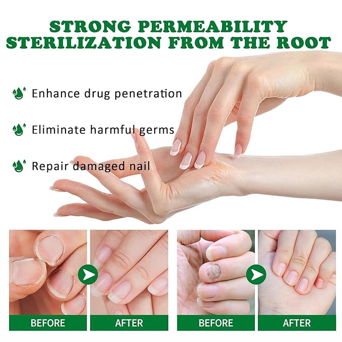 7 Day Nail Treatment, Nail Strengthener and Growth & Oregano Tea Tree Oil for Toenail: Safely and Gently, Daily Maintenance