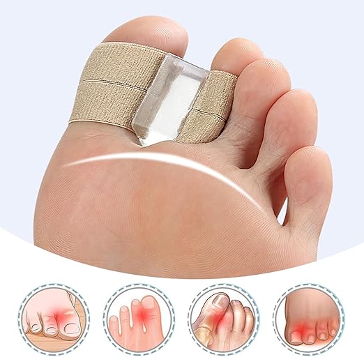 Toe Spacers for Women & Men - Bunion Corrector with Elastic Band, Silicone Toe Separators for Overlapping Toes, Correct Toes & Foot Pain Support