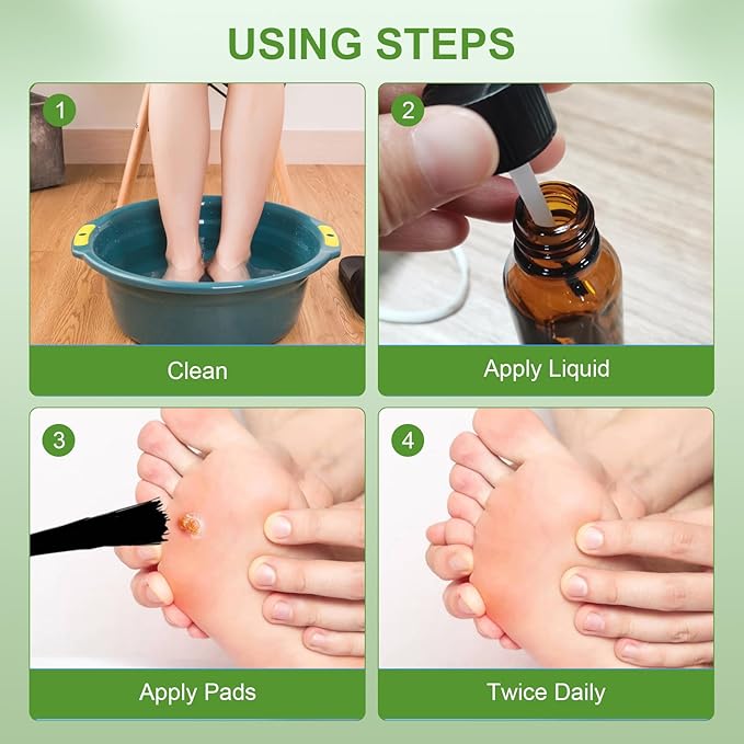 MQFORU Corn Remover, Corn Removers for Toes, Callus Remover for Fast-Acting Foot Care - Plantar and Common Callus Remover 15ML (0.51 oz 15 pcs Pads)