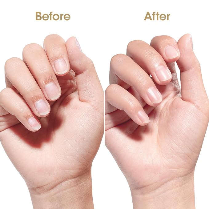 Gellen Nail Cuticle Oil for Growth and Strength, Natural Keratin Vitamin E Nail Growth Oil, Organic Cuticle Nails Serum for Hydrating, Nourishing, Strengthening, Repairing