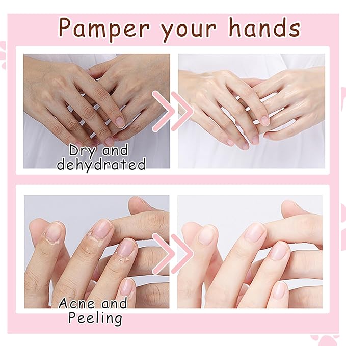 Hand Masks, 6 Pairs Hydrating Exfoliating Hand Peeling Mask, Smooth Hand Masks Moisturizing Gloves Overnight for Dry, Rough, Cracked Hands, Hand Skin Moisturizer Glove for Women Men（B