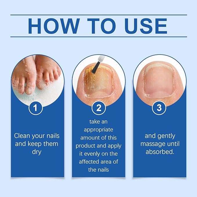 Nail Repair Liquid - Removes Discolored Nails Softens Thick Toenail Strengthens Nail Bed Structure, Natural Formula Deeply Nourishes Nail (1FL.oz)
