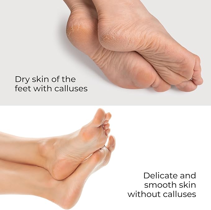 Nano Glass Foot File Callus Remover Professional Pedicure Tool for Feet, Heel Scraper for Cracked Heels, Foot Scrubber for Dead Skin with Pedicure Kit