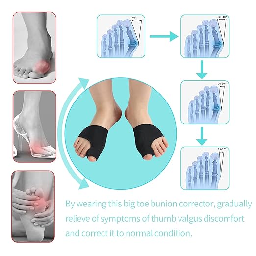 Bunion Relief Sleeve For Men Women And Kids，Bunion Corrector Sleeve Socks For Hallux Valgus，Big Toe Separators and Pinky Separators Pack （Black, Small