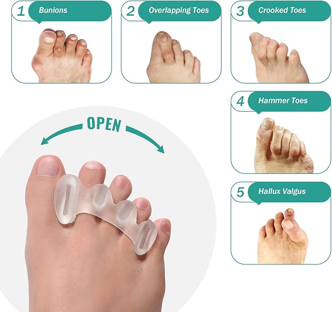 Welnove Toe Separators - 2 Pairs Toe Spacers for Women Men to Correct Bunion, Toe Straighteners for Plantar Fasciitis, Hammertoes, Relieve Feet Pain, Foot Alignment - S