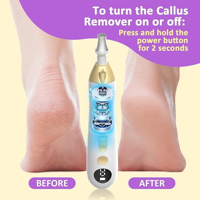 Callus Remover for Feet, Electric Foot Callus Remover - 8 Grinding Heads, 9 Speeds, Rechargeable Foot File - Professional Pedicure Tool for Hard Skin, Calluses & Cracked Feet Black