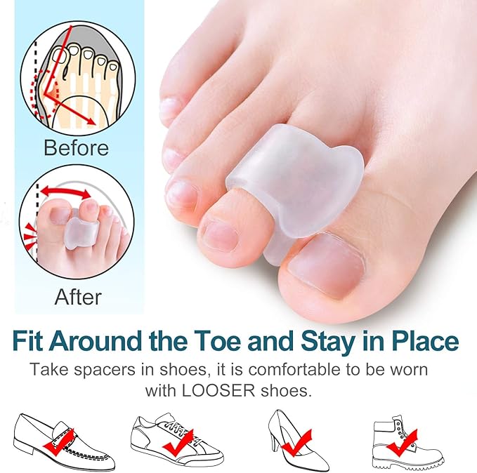 Povihome 10 Pack Clear Toe Spacers, Big Toe Separator (1st/2nd Toe), Bunion Corrector to Correct Big Toe Bunion, Overlapping Toes