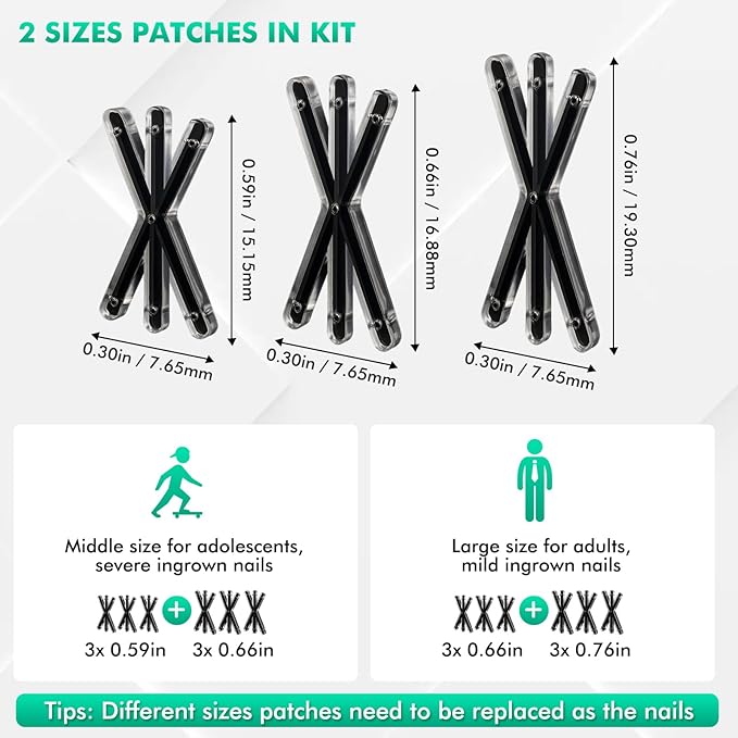 Ingrown Toenail Correctors Tripled, Quick Relief Ingrown Toenail Treatment Removal Tool Kit at Home, Curve Correct for Big Toe Ingrown Nail Outgrow Lifter Sticks To The Nail 0.59/0.66in