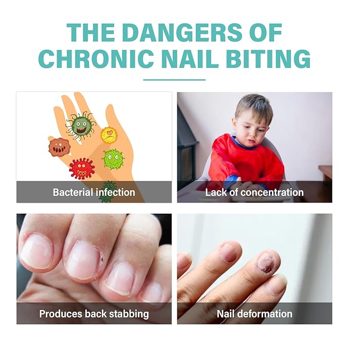Nail Biting Prevention, 2 Pcs No Biting Treatment for Kids & Adults, Stop Nail Biting Safe