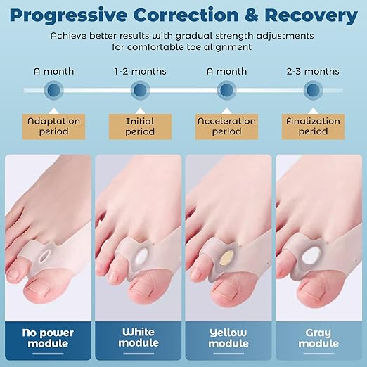 Adjustable Bunion Corrector Kit & Toe Separator for Women and Men, Big Toe Straightener, Pain Relief for Bunions, Hammer, Overlapping Toes, with Modules - Bunion Corrector and Spacers