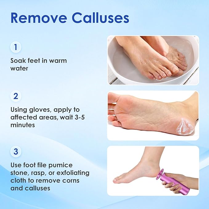 Professional Callus Remover for Feet – Extra Strength Foot Callus Remover Gel with 2 Glass Sandpaper Discs for Electric Foot Callus Remover,Foot Care kit - 50 ml/1.76 fl.oz