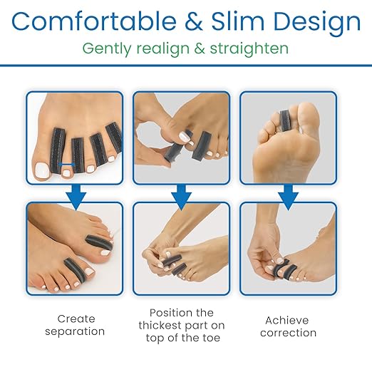 VIVEsole Foam Toe Separators for Women & Men (20 Pack) - Spacers for Bunions, Corns, Blisters, Overlapping Toes & Hammer Toe Pain Relief - Cushion Pads Prevent Friction & Reduce Pressure