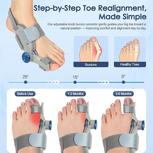 Bunion Corrector for Women Men Big Toe,Adjustable Knob Bunion Corrector for Bunion Relief,Bunion Fix with Bunion Silicone Pad,Suitable for Left and Right Feet(2PCS)