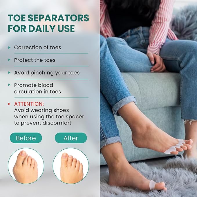 Welnove Toe Separators - 8 Pcs Toe Spacers for Women and Men - Restoring Toes to Their Original Shape - Silicone Toe Spreaders for Yoga Practice - Extra Large