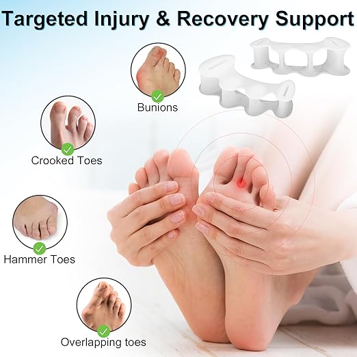 2Pairs Toe Spacers for Women and Men, Toe Separators for Correct Bunion, Relieve Feet Pain, Foot Alignment, Toe Straighteners for Hammertoes, Plantar Fasciitis (Small)