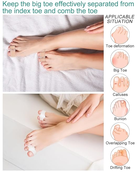 4Pcs Toe Separators Bunion Corrector for Women Men, Gel Big Toe Spacers with 2 Loops for Feet, Hammer Toe Straightener, Elasticity and Soft (2Nylon+2Gel)