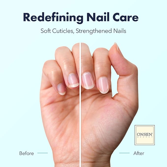 Onsen Secret Nail & Cuticle Repair Oil (30ml) - Dry Oil Formula - Japanese Tsubaki, Tea Tree & Jojoba - Strengthens Nails, Repairs Cuticles, Hydrates Skin & Hair - Natural & Vegan