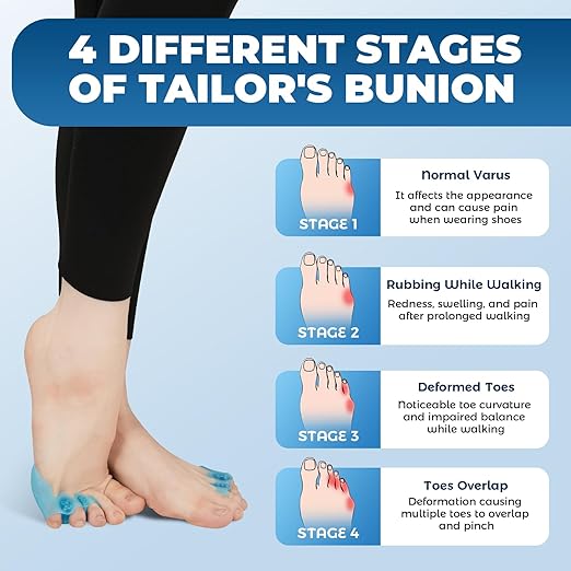 Tailor’s Bunion Corrector and Pinky Toe Separators - Gel Protectors for Pain Relief, Overlapping, Curled Toes - Little Straightener - Adjustable Tailor Pads - Toes Spacer (Blue)