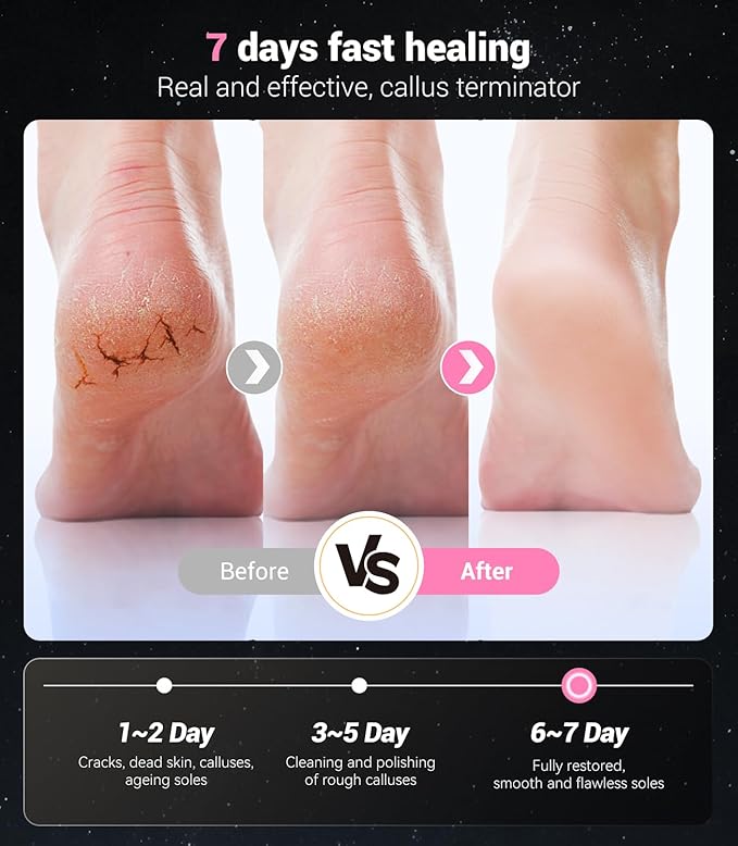5-in-1 Professional Electric Foot Callus Remover(Portable & Foldable), Removes 99.92% of Calluses in 3 Mins, Rechargeable Foot File Pedicure Kits with 10 & 40 Grit Pads for Smooth Feet, Pink