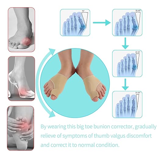 Bunion Corrector Sleeve Socks with Big Toe Separators and Pinky Separators Pack for Men and Women Non-Slip Big Toe Straightener Big Toe Alignment Bunion Toe Relief Pain (Khaki, Small)