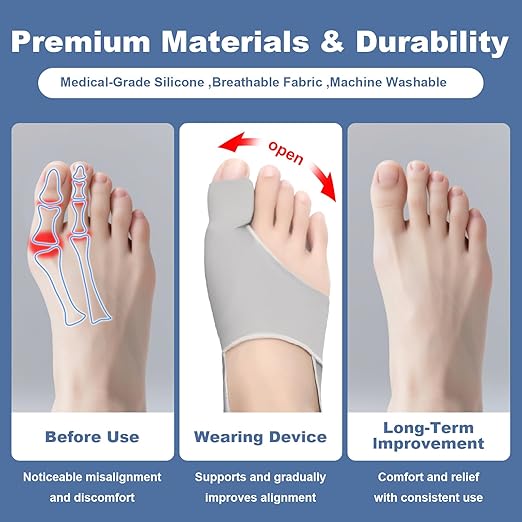 2-Pack Bunion Corrector for Women & Men – Toe Straightener & Spacers, Relieves Bunion, Hallux Valgus & Pain – Comfortable & Breathable, Day & Night Use