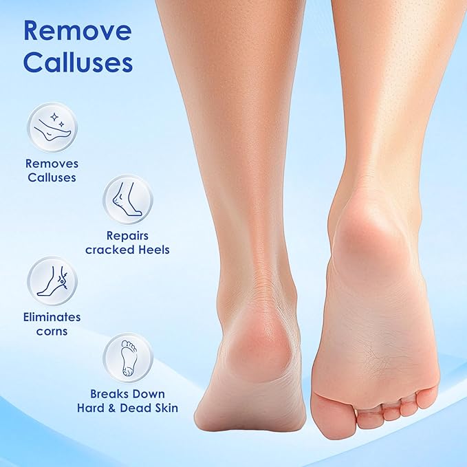 Professional Callus Remover for Feet – Extra Strength Foot Callus Remover Gel with 2 Glass Sandpaper Discs for Electric Foot Callus Remover,Foot Care kit - 50 ml/1.76 fl.oz