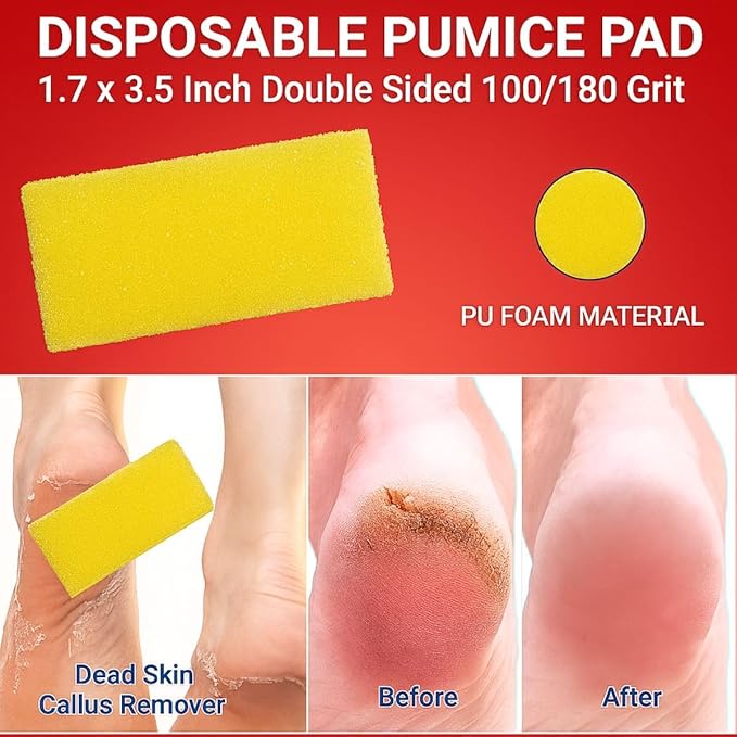 Disposable 4-Piece Pedicure Kit, 200 Count – Individually Wrapped Spa Set with Yellow Pumice, White 80/100 Grit Nail File, Orange Buffer, Toe Separators – Nail Care for Salon & Home Use