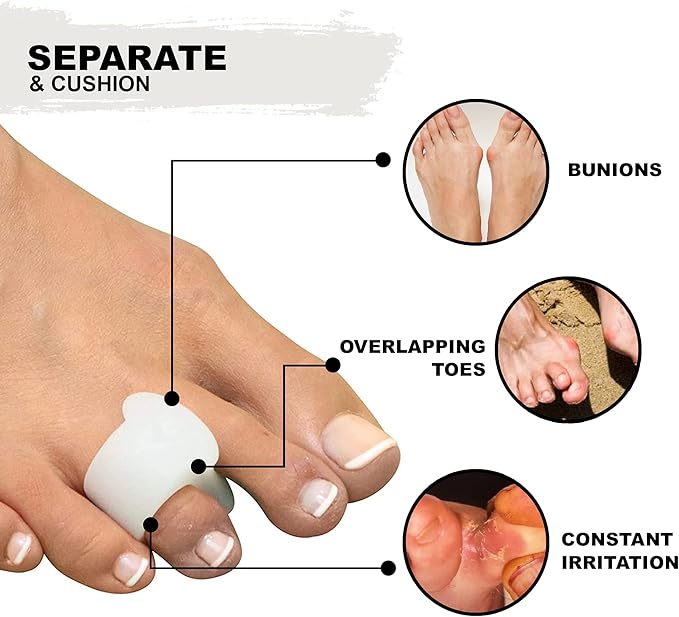 Mars Wellness Gel Toe Separator and Toe Spacers - Bunion, Hammer Toe, Overlapping Toes, Toe Spreader and Toe Corrector for Men and Women - 4 Pack - White Small