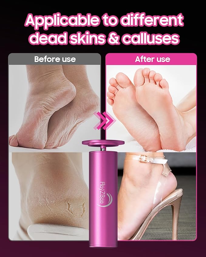 Electric Foot Callus Remover - Electric Callus Remover for Feet,Adjustable Speed Foot Scrubber with 60 Pcs Sandpaper Discs,Professional Pedicure Tool for Dead Skin and Calluses - Matte Purple