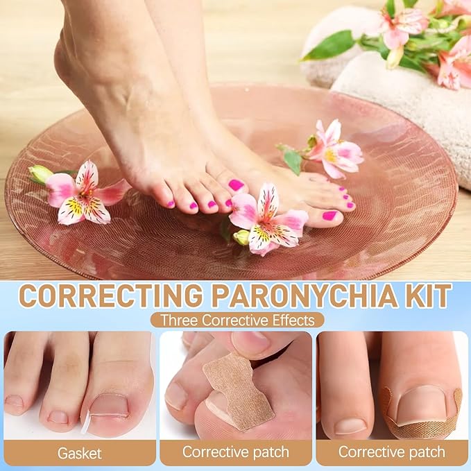 Ingrown Toenail Treatment,50Pcs No Glue Breathable Toenail Corrector Patch with File and Lifter,Professional Ingrown Toenail Corrector,Ingrown Toenail Tools for Quick Relief