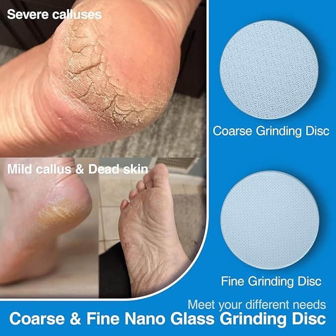 2 Pcs Nano Glass Replaceable Sandpaper Disc for APRELM Electric Foot Callus Remover with 60 Pieces Replaceable Round Double-Sided Adhesive Pads