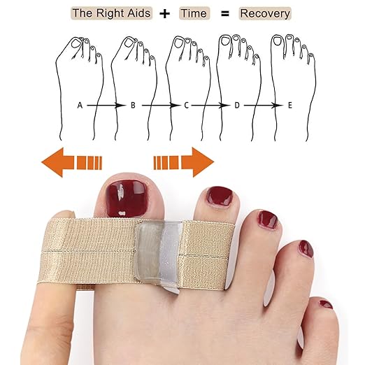 Toe Spacers for Women & Men - Bunion Corrector with Elastic Band, Silicone Toe Separators for Overlapping Toes, Correct Toes & Foot Pain Support