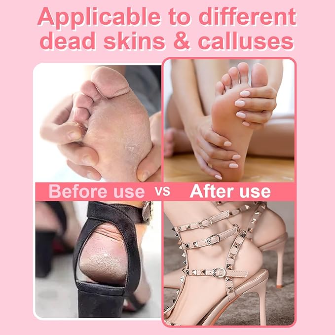 Electric Foot Callus Remover - Callus Remover for Feet,Professional Pedicure Tool for Dead Skin and Calluses,Adjustable Speed Foot File with 60 Pcs Sandpaper Discs - Pink
