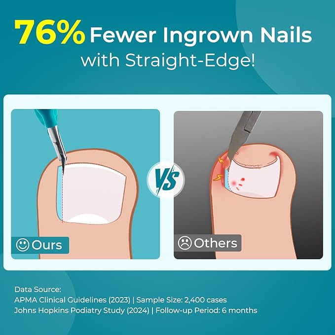Wanmat Professional Ingrown Toenail Clipper: Straight Edge Nail Clippers for Men Women - Runners/Athletes Aged 16-45 - Compact Thick Fingernail Cutter for Gym Bag/Travel