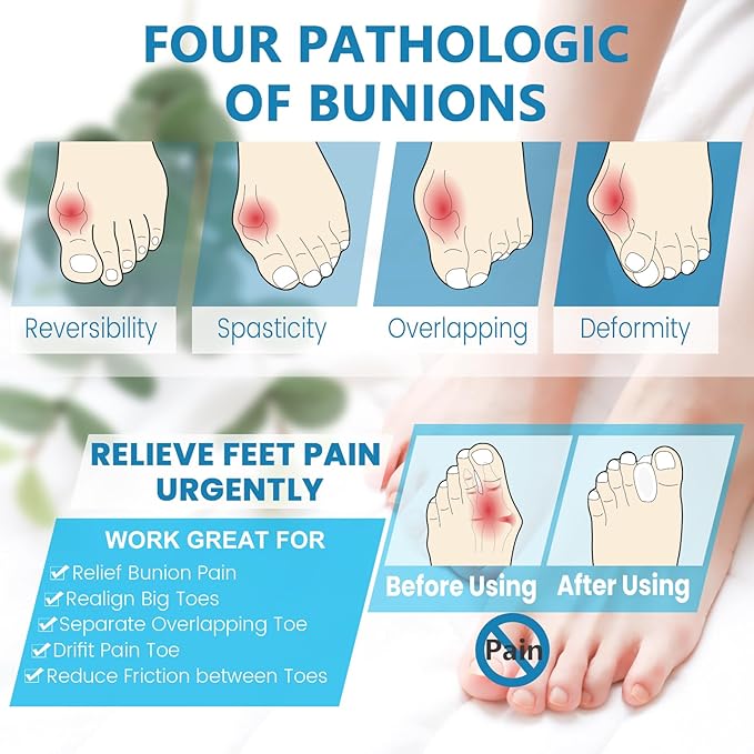 Toe Spacers(1/2"), Happiby Silicone Toe Separators for Bunion, Overlapping Toes and Toe Pain Relief, Big Toe Alignment, 5 Pairs/10 Pcs