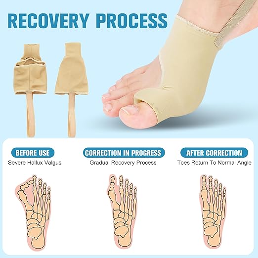 Bunion Corrector Sleeve for Women & Men - Big Toe Spacers with Foot Bunion Pads,Hallux Valgus Support & Discomfort Relief - Flexible Breathable Bunions Sleeve Socks for Day and Night Use (M)
