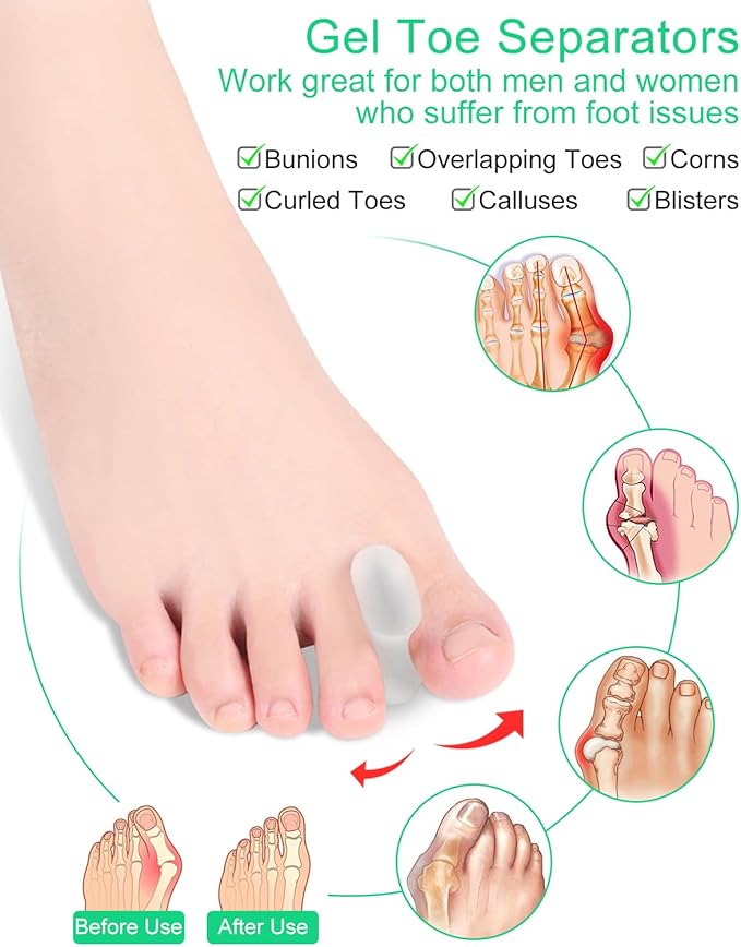 12 Pack Gel Toe Separators Silicone Toe Spacers for Women Men Bunion Corrector Toe Pain Relief, Toe Alignment, Soft Toe Spacer for Crooked Toes, Overlapping Toes, Hammertoe Correction (Small)