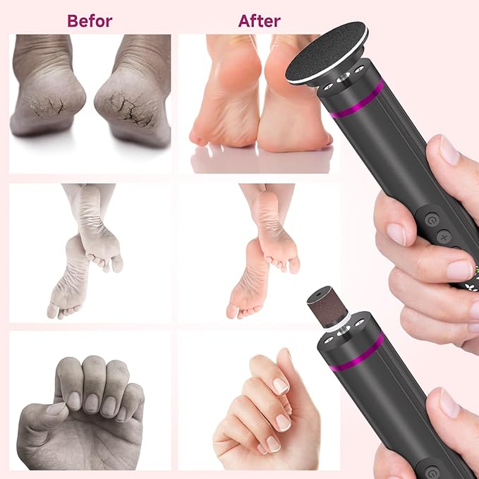 Dermave Electric Foot Callus Remover Cordless, 2 in 1 Wireless Electric Foot File, Adjustable 9 Speed Rechargeable Pedicure Foot Filer Tool w/Sandpaper Discs & Nail Drill Bits, Digital Display (Gray)