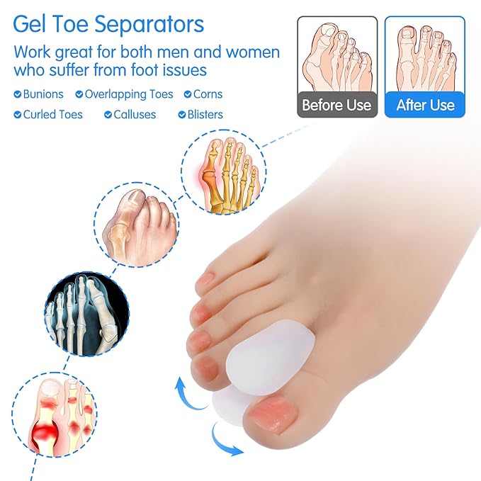 12 Pack Soft Gel Toe Separators for Women and Men, White Silicone Toe Spacers, Two Size Separators Toes Straighteners for Crooked Toes, Overlapping, Bunions, Calluses