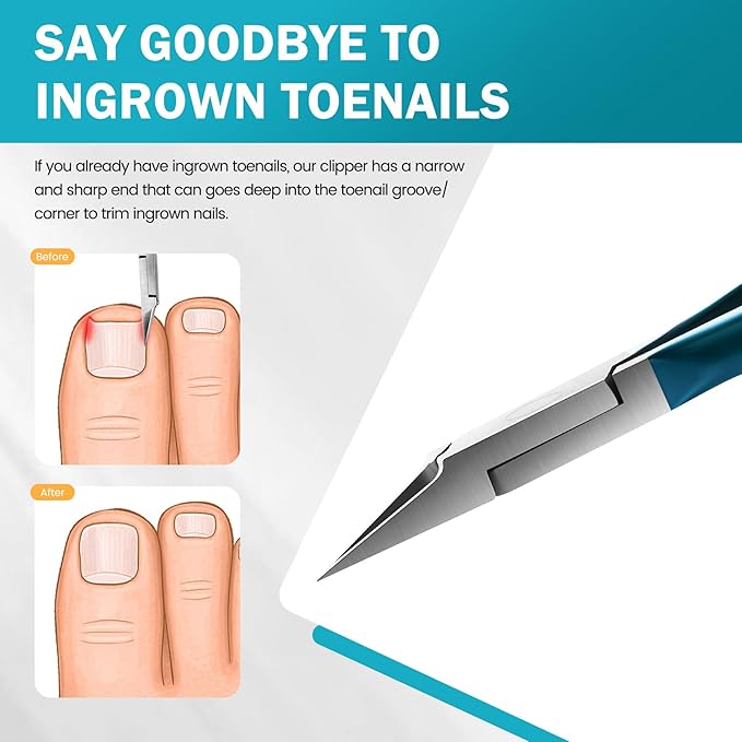 BEZOX Straight Blade Toenail Clippers - Wide Open Pointed Jaw Toe Nail Clippers for Ingrown Nails, Precision Grooming Toenail Scissors for Seniors Thick Toenails - Blue