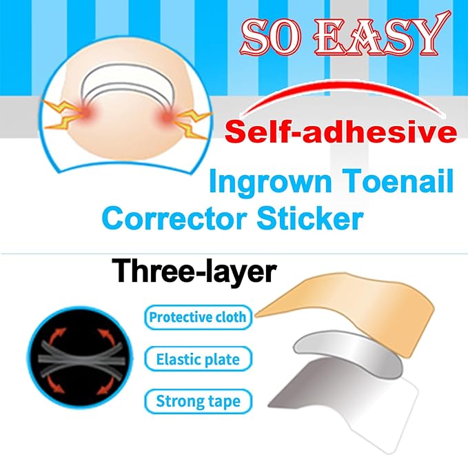 Professional Ingrown Toenail Toolkit with Breathable Ingrown Toenail Strips, Curved Toenails Corrector Patch, Painless File and Lifter for Home Pedicure Care