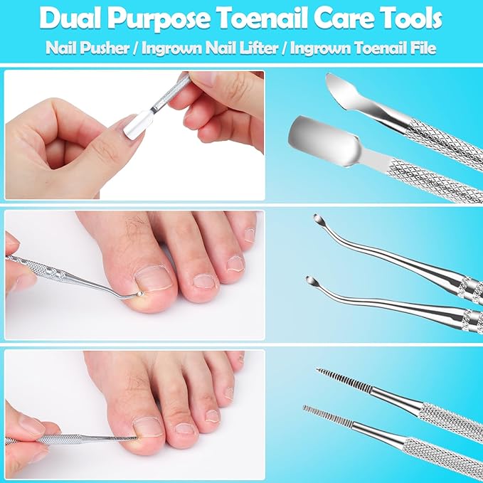 Modacraft 11-Piece Toenail Care Kit - Effective Ingrown Toenail Treatment with Toenail Clippers for Thick Toenails, Corrector & Other Pedicure Tools for Feet and Hand