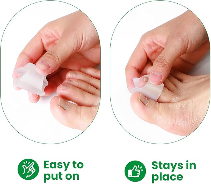 Bukihome Hammertoe Corrector - 6 Pack Toe Straightener to Curled Toes, Broken toe, Bunion Corrector for Women and Men, Large Size (Clear)