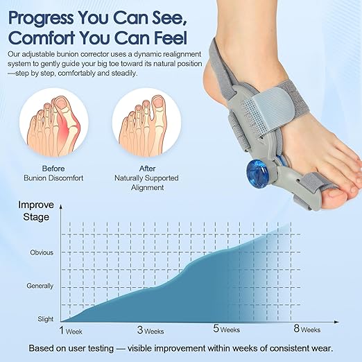 Bunion Corrector for Women Men Big Toe,Adjustable Knob Bunion Corrector for Bunion Relief,Bunion Fix with Bunion Silicone Pad,Suitable for Left and Right Feet(2PCS)